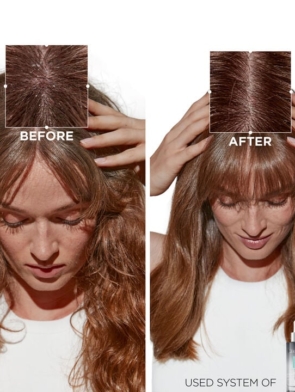 kerastase-serum-nuit-antipelliculaire-anti-dandruff-night-hair-serum-before-after