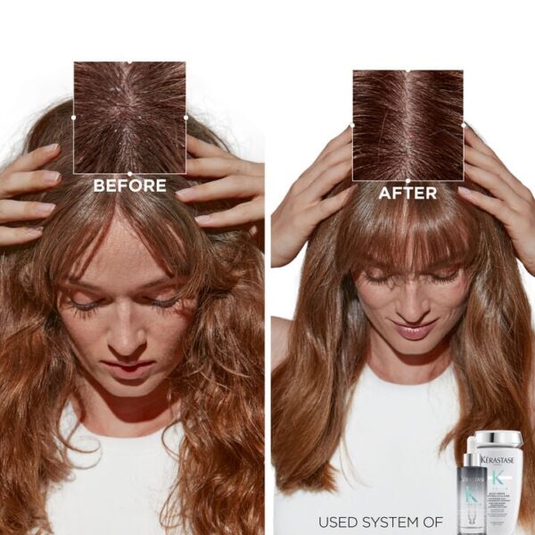 Kérastase Symbiose Intensive Anti-Dandruff Cellular Night Serum - Image 2
