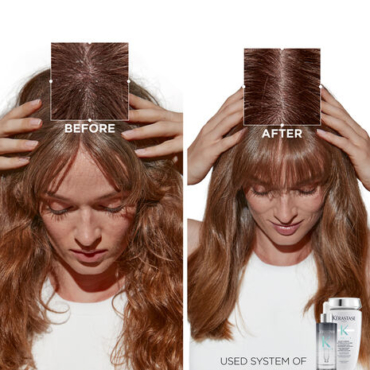 kerastase-bain-creme-antipelliculaire-anti-dandruff-shampoo-beforeafter